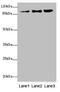 Zinc Finger Protein 148 antibody, LS-C676743, Lifespan Biosciences, Western Blot image 