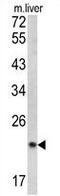 Signal Peptidase Complex Subunit 3 antibody, GTX81778, GeneTex, Western Blot image 