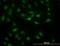 Signal Transducer And Activator Of Transcription 5B antibody, orb94770, Biorbyt, Immunofluorescence image 
