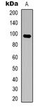 Hyperpolarization Activated Cyclic Nucleotide Gated Potassium And Sodium Channel 2 antibody, abx133729, Abbexa, Western Blot image 