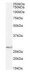 Siah E3 Ubiquitin Protein Ligase 1 antibody, orb372991, Biorbyt, Western Blot image 