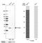 Tetratricopeptide Repeat Domain 39A antibody, NBP1-88333, Novus Biologicals, Western Blot image 