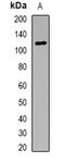 Ectonucleotide Pyrophosphatase/Phosphodiesterase 2 antibody, abx225160, Abbexa, Western Blot image 