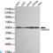 Thioredoxin Reductase 2 antibody, LS-C813143, Lifespan Biosciences, Western Blot image 