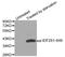 Eukaryotic Translation Initiation Factor 2 Subunit Alpha antibody, TA333193, Origene, Western Blot image 