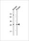 Rho Family GTPase 3 antibody, GTX81316, GeneTex, Western Blot image 