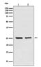 BCL2 antibody, M00040-1, Boster Biological Technology, Western Blot image 