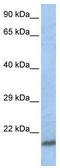 SCAN Domain Containing 1 antibody, TA331908, Origene, Western Blot image 