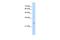 Immediate Early Response 2 antibody, A10845, Boster Biological Technology, Western Blot image 