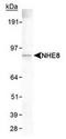 Sodium/hydrogen exchanger 8 antibody, TA301650, Origene, Western Blot image 