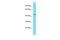 Delta Like Non-Canonical Notch Ligand 2 antibody, PA5-69625, Invitrogen Antibodies, Western Blot image 