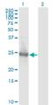 Kirre Like Nephrin Family Adhesion Molecule 2 antibody, H00084063-M01, Novus Biologicals, Western Blot image 