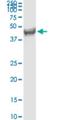 Farnesyl-Diphosphate Farnesyltransferase 1 antibody, H00002222-M01, Novus Biologicals, Western Blot image 