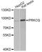 Protein Kinase C Theta antibody, STJ28397, St John