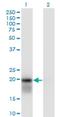 Ubiquitin Conjugating Enzyme E2 H antibody, H00007328-M01, Novus Biologicals, Western Blot image 