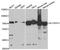 Solute Carrier Family 25 Member 13 antibody, A5849, ABclonal Technology, Western Blot image 