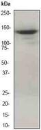 Inositol Polyphosphate-5-Phosphatase D antibody, ab45142, Abcam, Western Blot image 