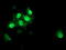 S100 Calcium Binding Protein P antibody, LS-C337671, Lifespan Biosciences, Immunofluorescence image 