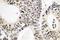 p53 antibody, LS-C177769, Lifespan Biosciences, Immunohistochemistry paraffin image 