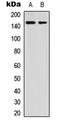 Cyclin G Associated Kinase antibody, LS-C356049, Lifespan Biosciences, Western Blot image 