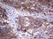 Phosphatidylinositol-4-Phosphate 3-Kinase Catalytic Subunit Type 2 Alpha antibody, LS-C336367, Lifespan Biosciences, Immunohistochemistry paraffin image 