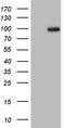 Protein Kinase CGMP-Dependent 2 antibody, LS-C798435, Lifespan Biosciences, Western Blot image 