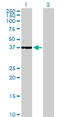Cyclin Dependent Kinase 6 antibody, LS-B5388, Lifespan Biosciences, Western Blot image 