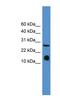 Interleukin 5 antibody, NBP1-69163, Novus Biologicals, Western Blot image 