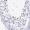 Sentan, Cilia Apical Structure Protein antibody, NBP2-38853, Novus Biologicals, Immunohistochemistry paraffin image 