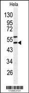 Serpin Family H Member 1 antibody, 62-857, ProSci, Western Blot image 