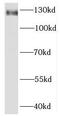 Kirre Like Nephrin Family Adhesion Molecule 3 antibody, FNab04591, FineTest, Western Blot image 