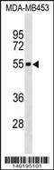 IL-5R-alpha antibody, 60-404, ProSci, Western Blot image 