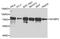 Insulin Like Growth Factor 2 MRNA Binding Protein 3 antibody, STJ24142, St John