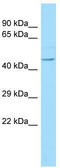 Notchless Homolog 1 antibody, TA338041, Origene, Western Blot image 