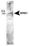 WNK1 antibody, NB600-225, Novus Biologicals, Western Blot image 