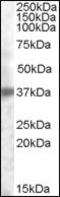 Tumor Associated Calcium Signal Transducer 2 antibody, orb95334, Biorbyt, Western Blot image 