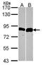Thimet Oligopeptidase 1 antibody, GTX114946, GeneTex, Western Blot image 