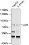 Alkaline Phosphatase, Biomineralization Associated antibody, 14-397, ProSci, Western Blot image 