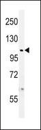 Deubiquitinating enzyme 8 antibody, 61-102, ProSci, Western Blot image 