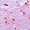 ETS Variant 1 antibody, LS-C352170, Lifespan Biosciences, Immunohistochemistry paraffin image 