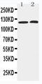 Histone Deacetylase 5 antibody, LS-C313286, Lifespan Biosciences, Western Blot image 