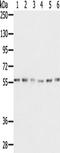 Serine Incorporator 2 antibody, TA351653, Origene, Western Blot image 