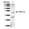 Protein Kinase C Gamma antibody, LS-C777323, Lifespan Biosciences, Western Blot image 