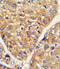 Leucine Rich Repeat Containing 32 antibody, LS-C98385, Lifespan Biosciences, Immunohistochemistry paraffin image 