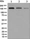 Rho Associated Coiled-Coil Containing Protein Kinase 2 antibody, ab125025, Abcam, Western Blot image 
