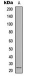 Interleukin 12A antibody, LS-B14275, Lifespan Biosciences, Western Blot image 