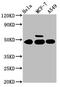 Casein Kinase 1 Gamma 1 antibody, CSB-PA888030EA01HU, Cusabio, Western Blot image 