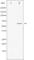 Gamma-Aminobutyric Acid Type A Receptor Beta1 Subunit antibody, abx010818, Abbexa, Western Blot image 