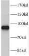 Threonyl-TRNA Synthetase Like 2 antibody, FNab08503, FineTest, Western Blot image 