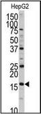 DCTP Pyrophosphatase 1 antibody, orb96111, Biorbyt, Western Blot image 